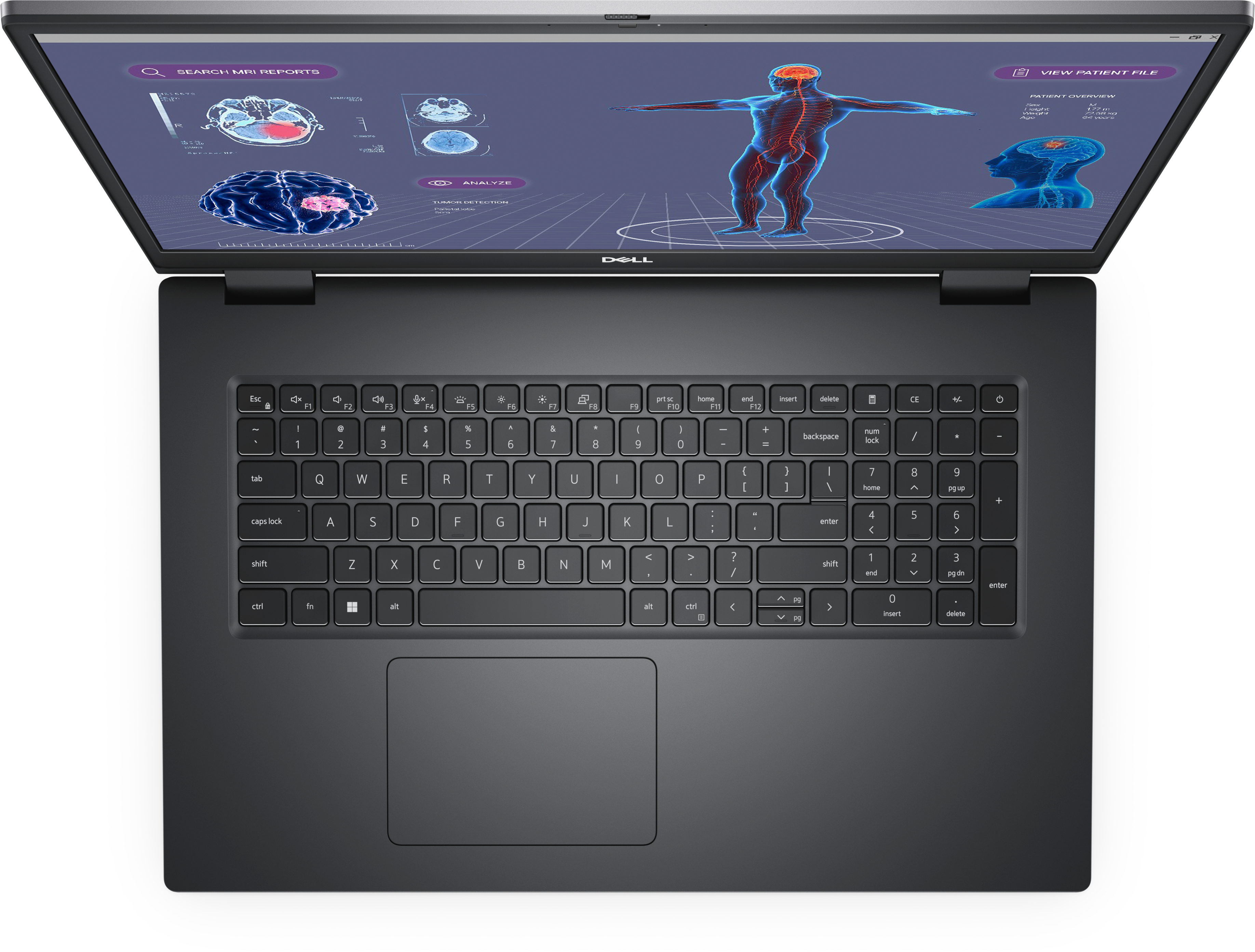 Dell Precision 7780, 17" FHD, Core i9-13950HX, 32GB RAM, 1TB SSD, RTX 3500 Ada, Win11 Pro