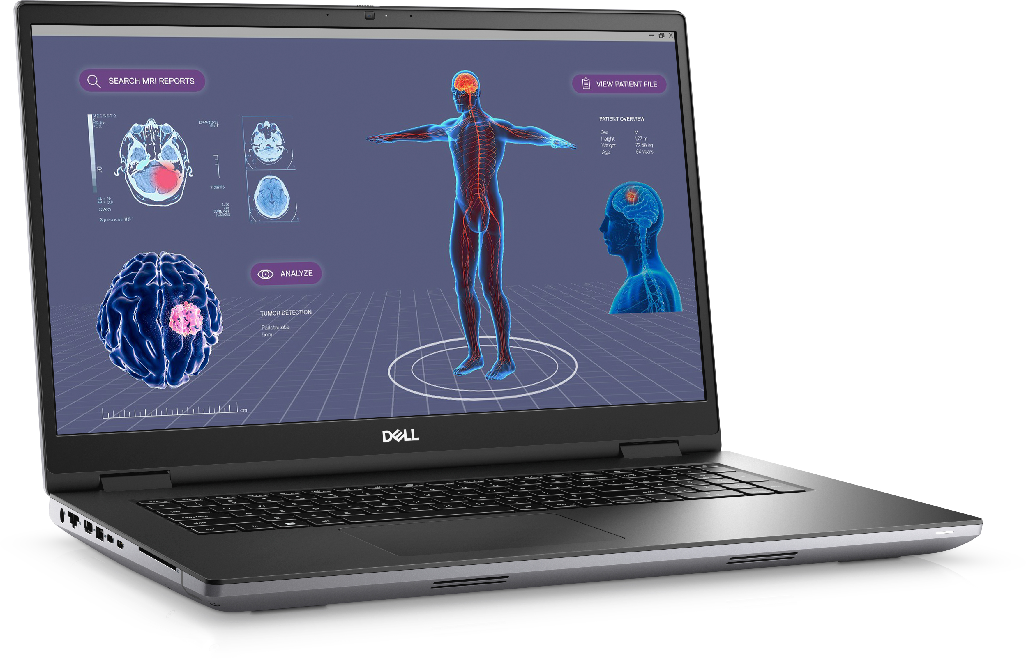 Dell Precision 7780, 17" FHD, Core i9-13950HX, 32GB RAM, 1TB SSD, RTX 3500 Ada, Win11 Pro
